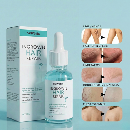 Ingrown Hair Repair Serum