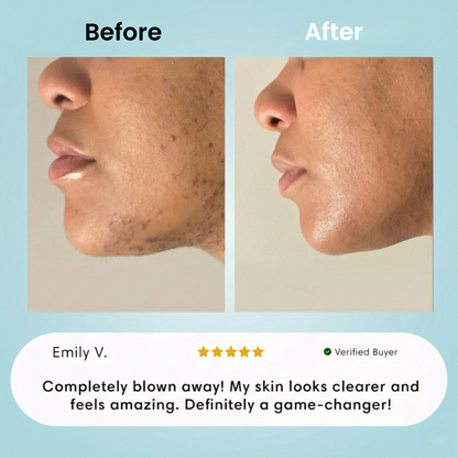 +1 Facial Hair Removal Cream.