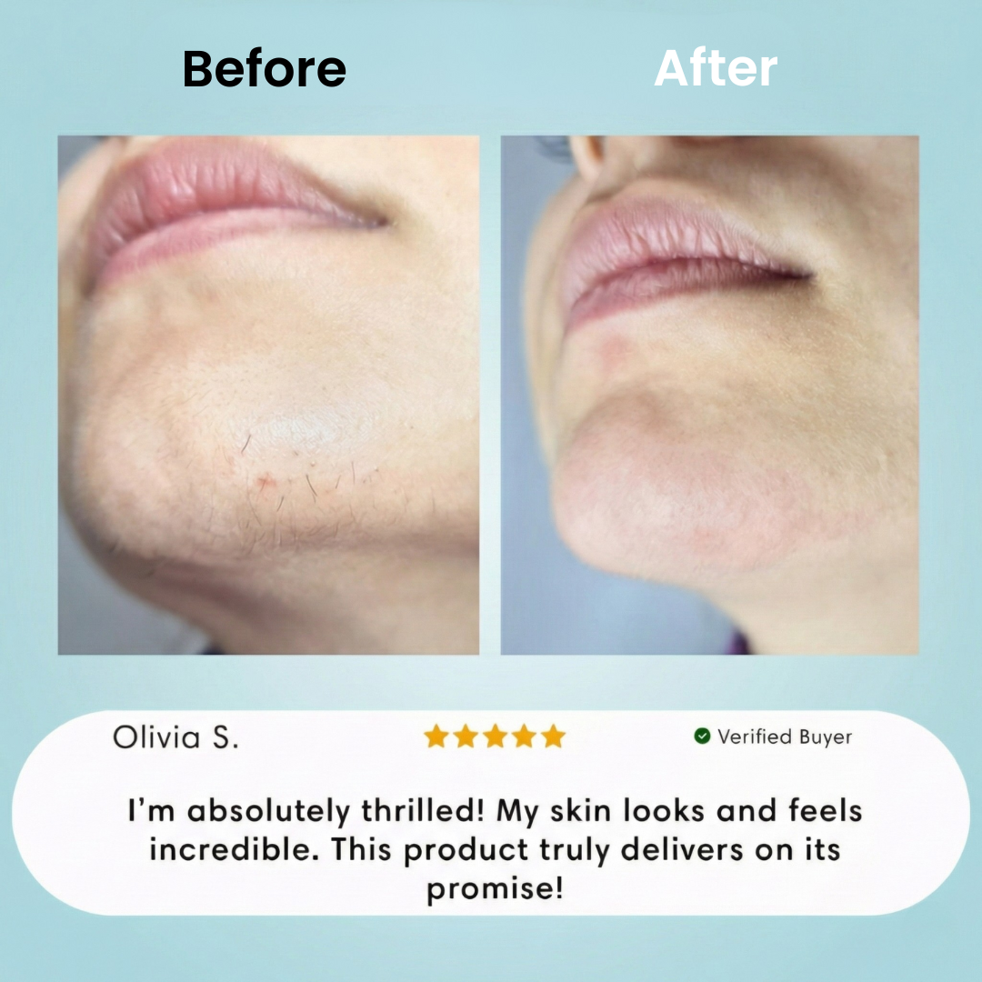 +1 Facial Hair Removal Cream.