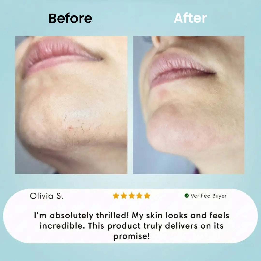 Facial Hair Removal Cream