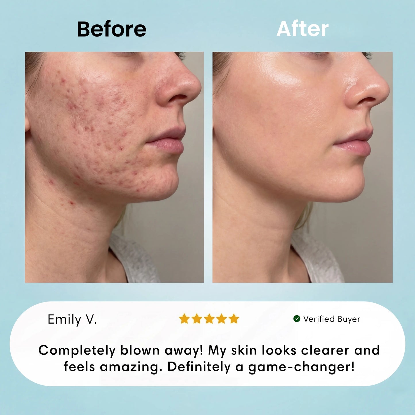 Facial Hair Removal Cream