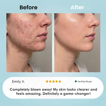 Facial Hair Removal Cream