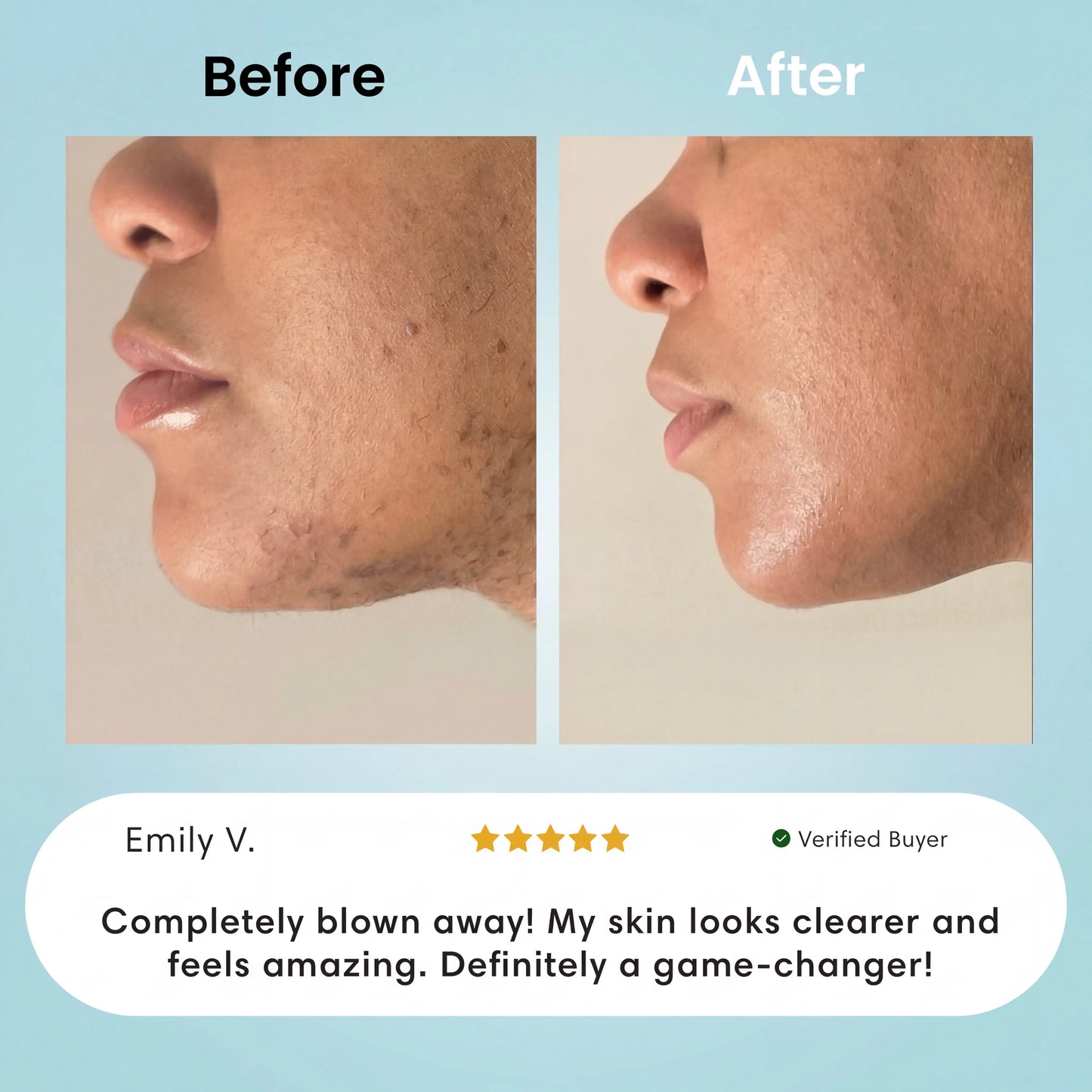 Facial Hair Removal Cream