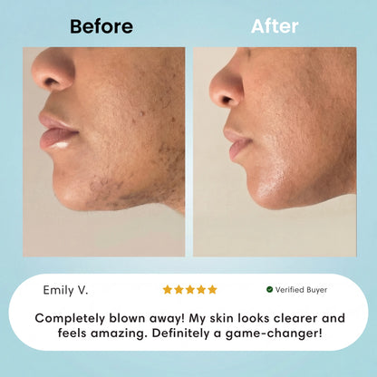 Facial Hair Removal Cream