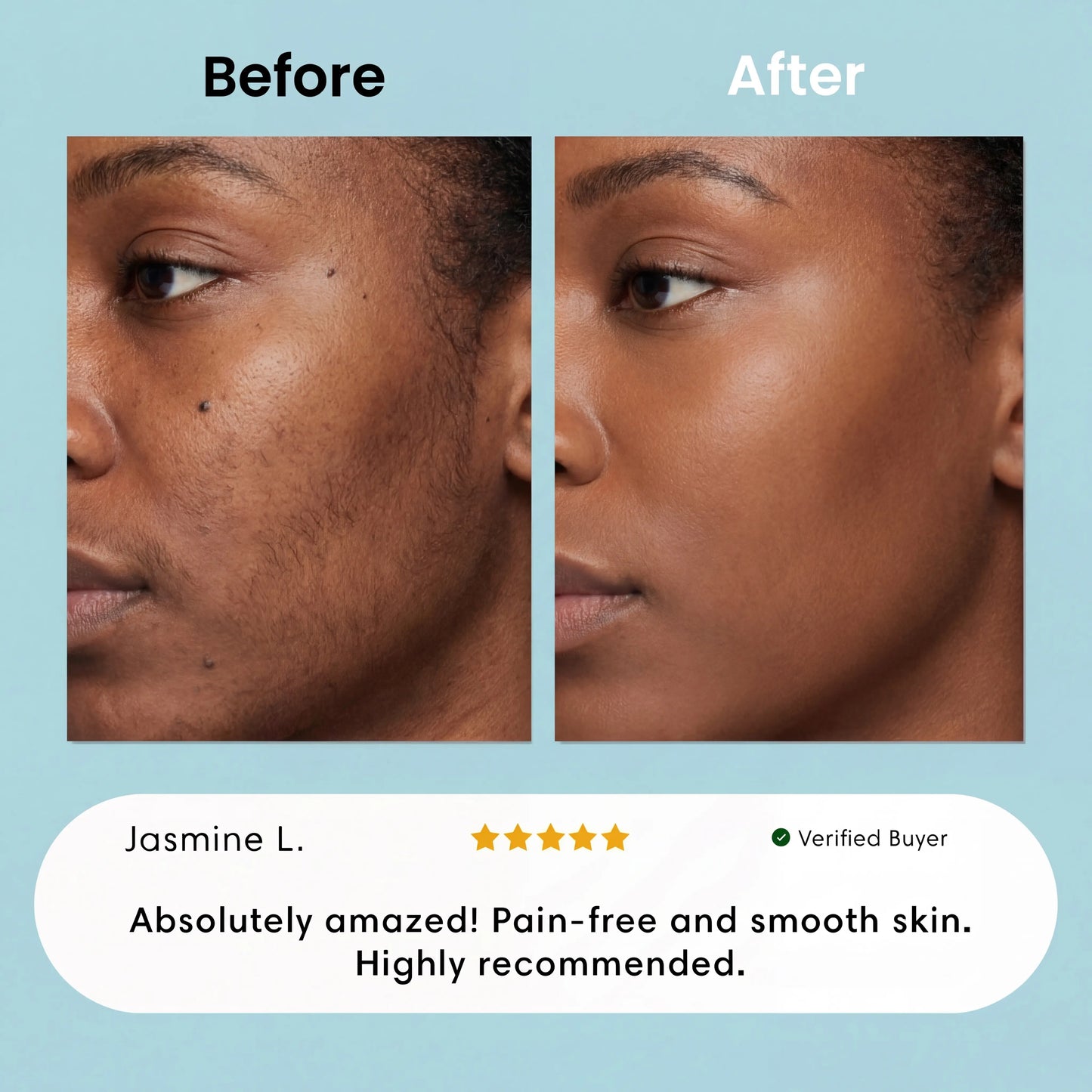 Facial Hair Removal Cream