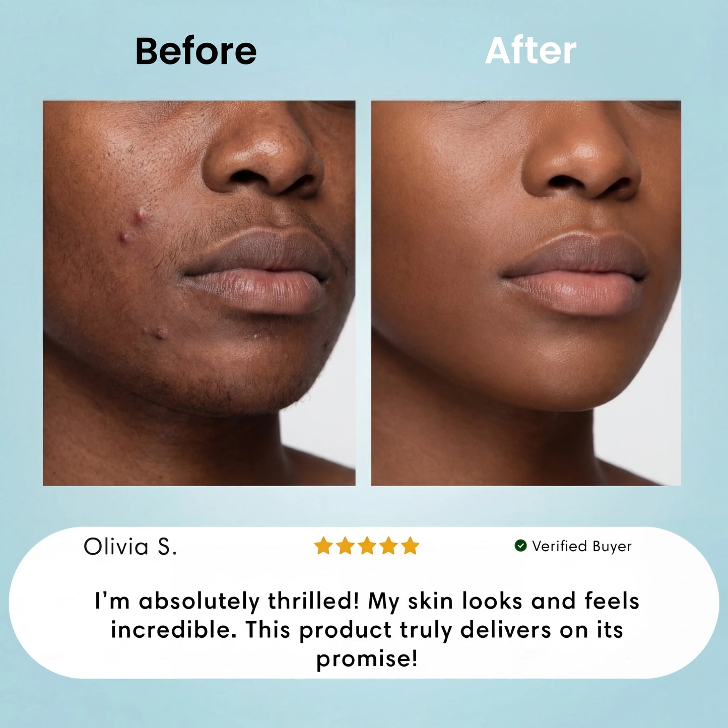 Facial Hair Removal Cream